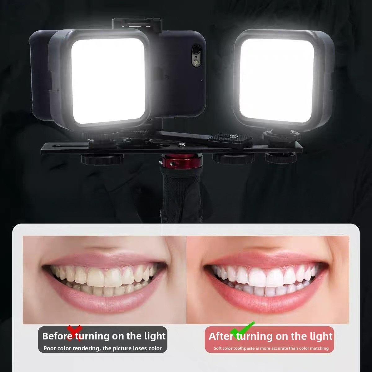 Photography Treatment - Dental Photography Light with Bluetooth Oral