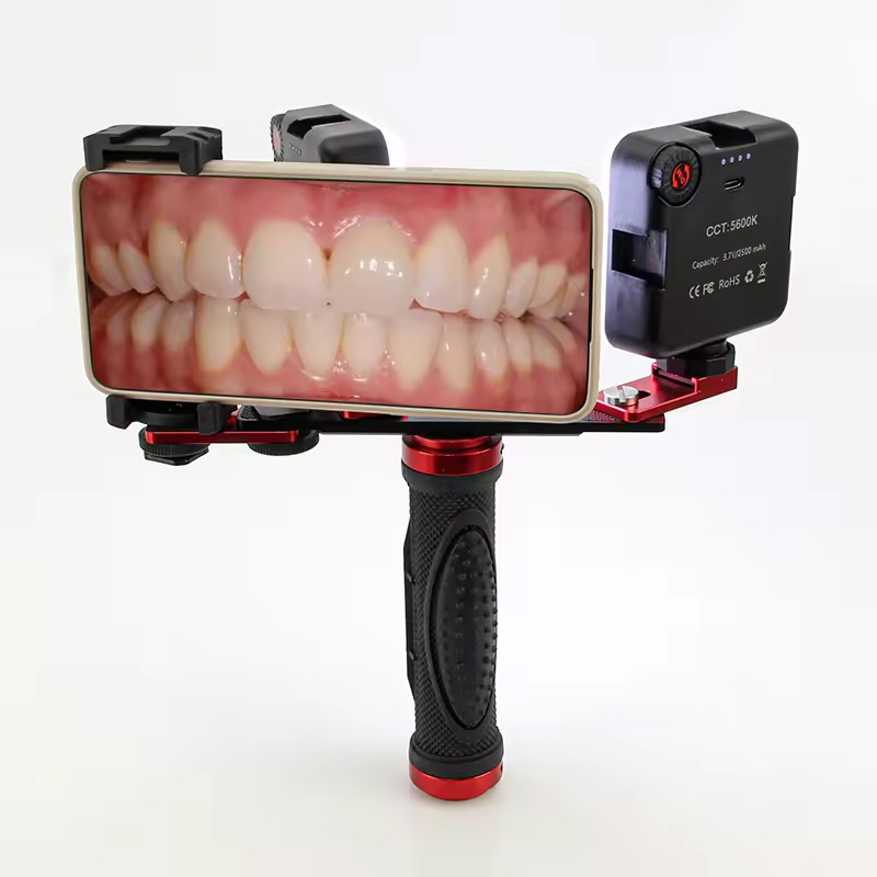 Photography Treatment - Dental Mobile Photography LED Light Intraoral