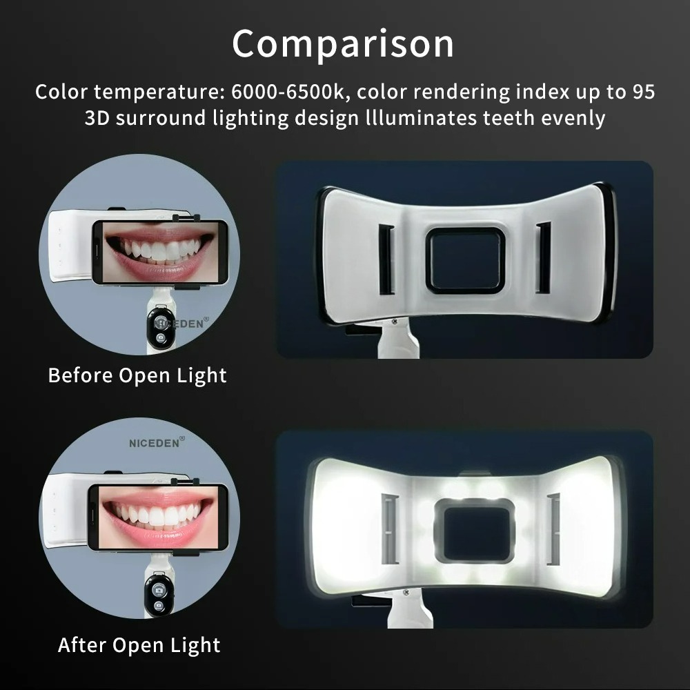 Dental Photography Light Phone - Photography Dental ulasan dan harga