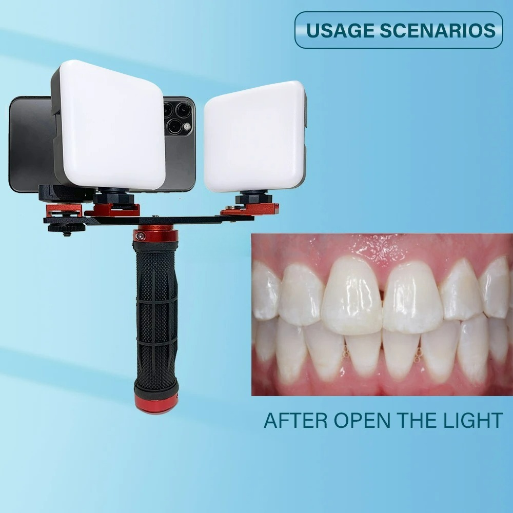Dental Photography Light Phone - Photography Dental ulasan dan harga
