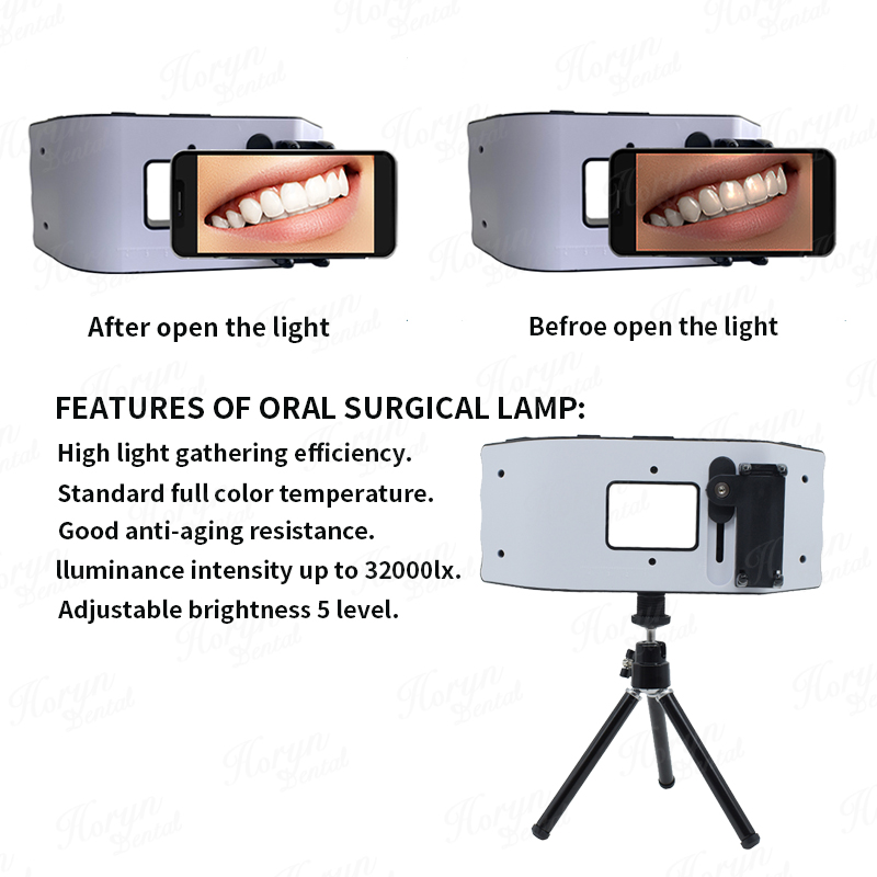 Dental Flash Light Photography - Photography Dental ulasan dan harga